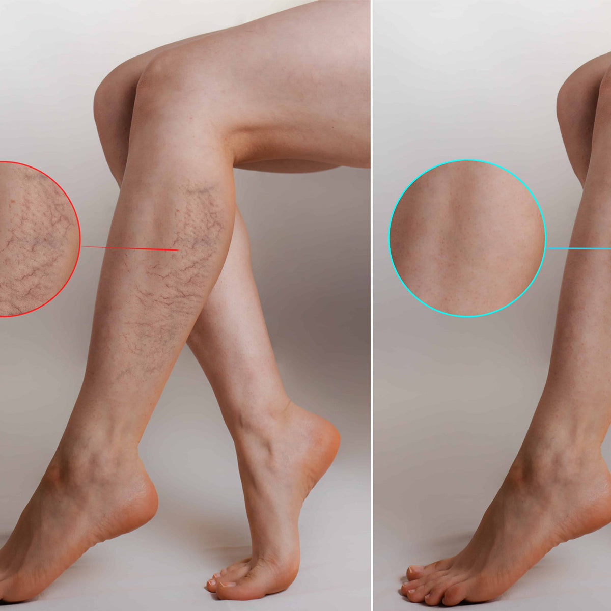 Venactiv Gel, 150 ml